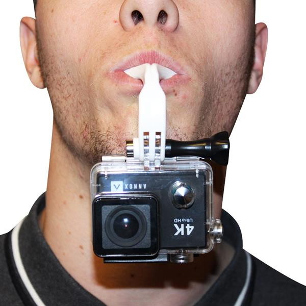 Annox Mouth Mount Set